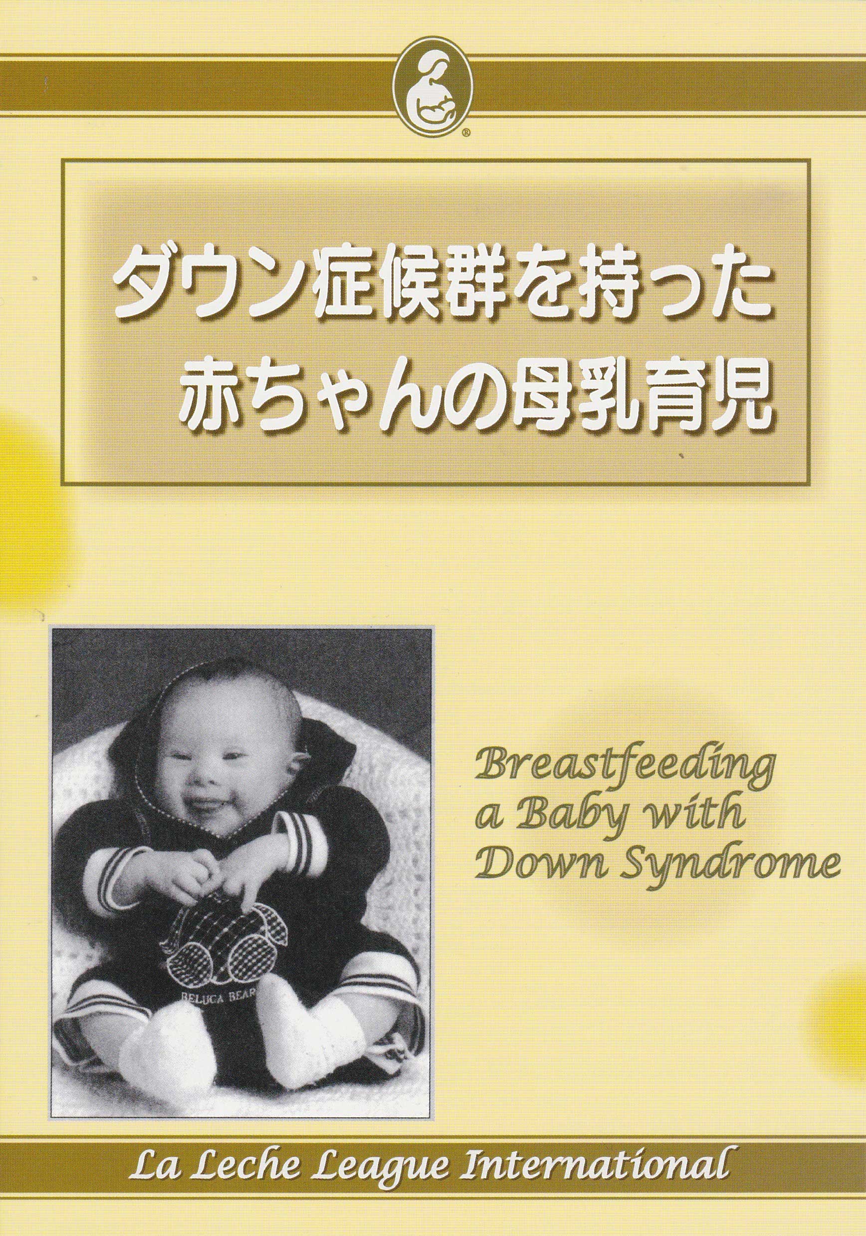 ダウン症候群を持った赤ちゃんの母乳育児